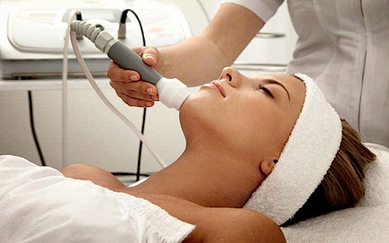Radiofrecuencia facial